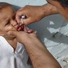 العراق.. اكتشاف أولى حالات مرض شلل أطفال منذ العام 2000  